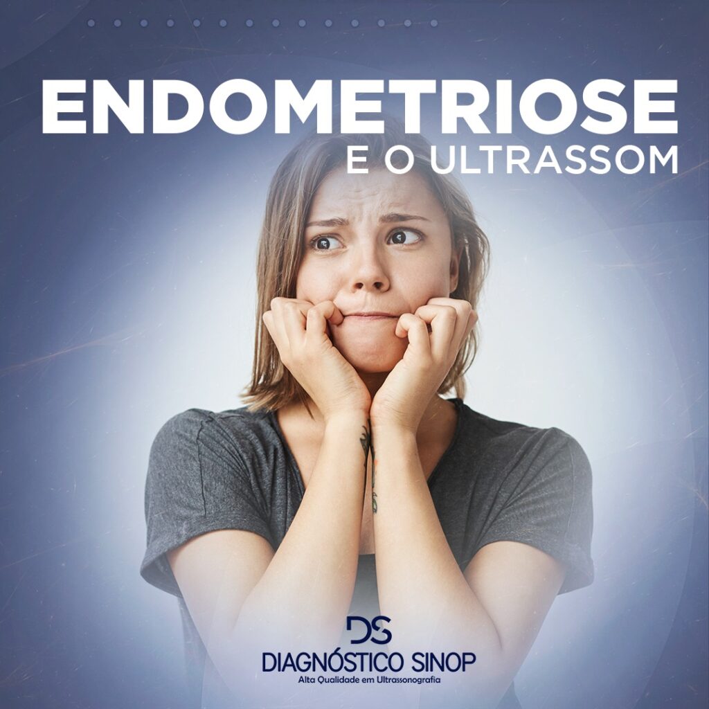 Endometriose e o Ultrassom Diagnóstico Sinop