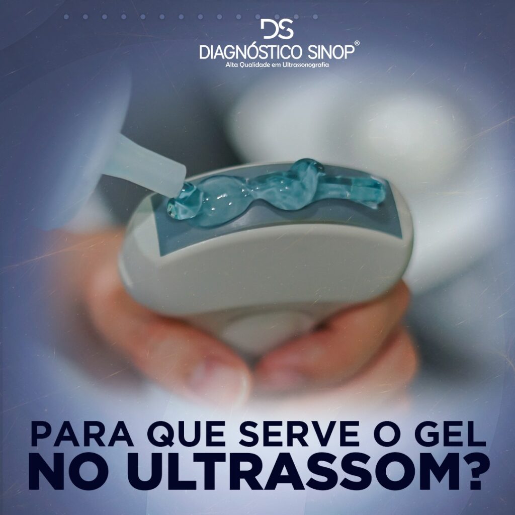 Para que serve o gel no ultrassom? – Diagnóstico Sinop